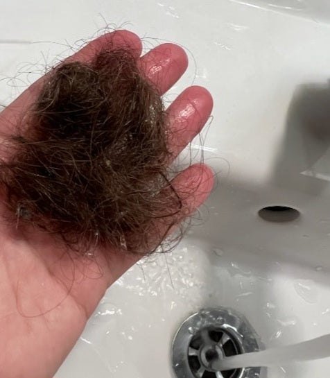 Hilfe! Vermehrter Haarausfall!